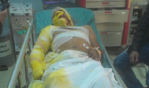 BEDAŞ'ta iş Kazaları Bitmiyor